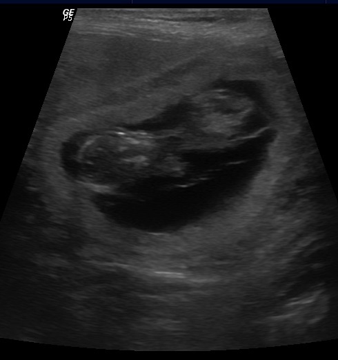 2015-0413-US 2015-0413-US